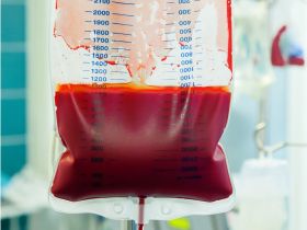 Pacjent ma przy sobie oświadczenie, że nie wyraża zgody na transfuzję krwi - jak postąpić