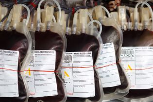 Co warto wiedzieć, wypełniając zlecenie na badanie grupy krwi
