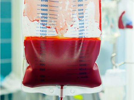 Transfuzja krwi